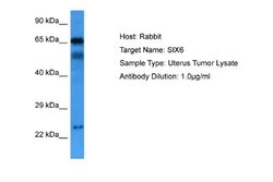 SIX6 Rabbit anti-Human, Polyclonal, Novus Biologicals 0.1ml; Unconjugated:Antibodies,